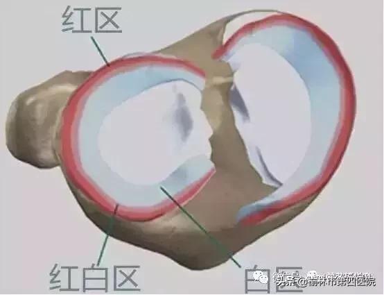 内侧半月板后角损伤怎么治疗,半月板损伤有积液的最好治疗