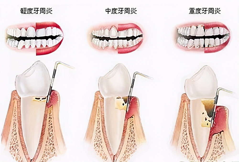 倪海厦讲白糖,猪油加白糖倪海厦