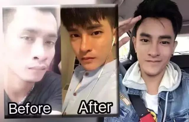 男子整容后从此走上人生巅峰,24岁小伙整容失败变大叔