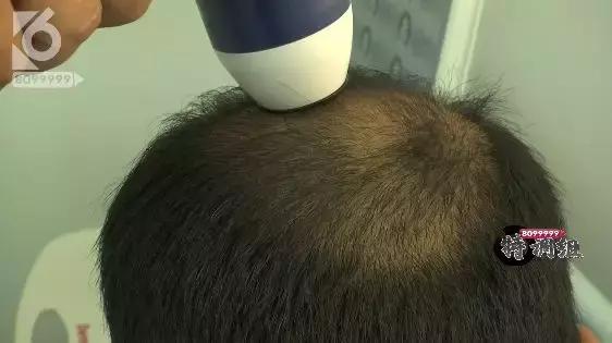 妞嶅彂闃查獥,璀︽儠妞嶅彂