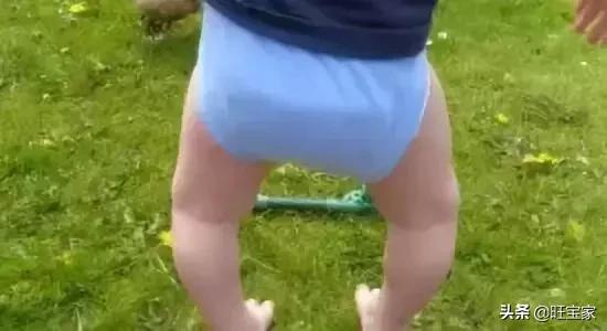 林允儿的o型腿,林允儿的o型腿走路