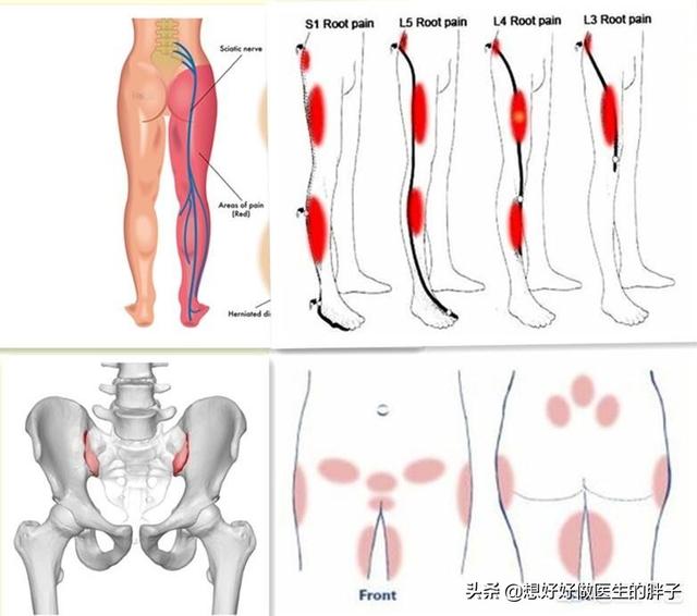 髋关节疼痛两腿不一样长如何康复,左大腿髋关节突然疼痛是什么原因