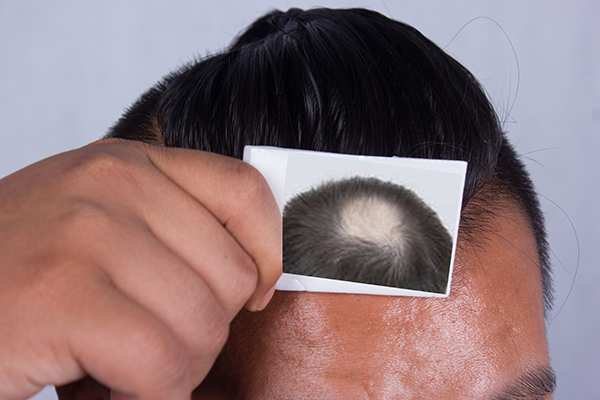 男性腿毛浓密说明什么,男性腿毛多的人说明什么