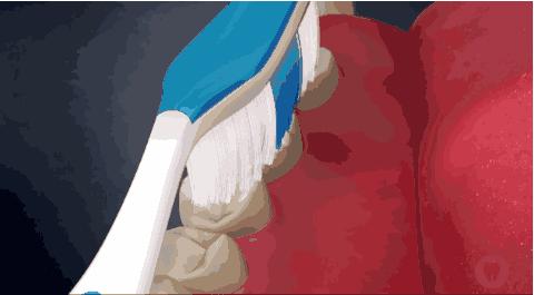 修复缺牙的最好方法,告别“老掉牙”看清这些招