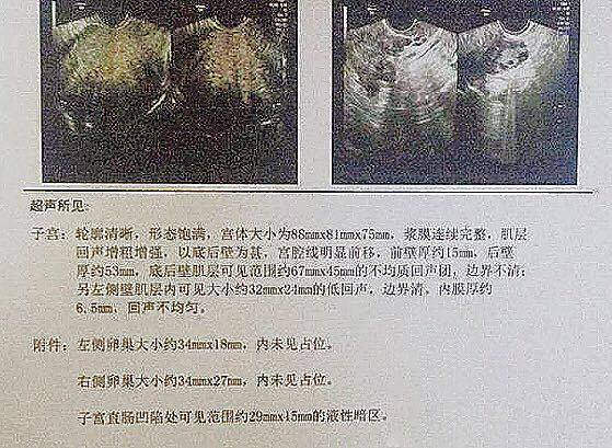 学会这六个技能让你人生更美好,学会这五个操作你就是电脑高手