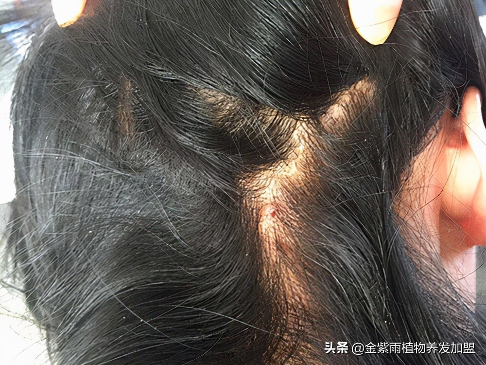 金紫雨植物染发养发连锁怎么加盟,金紫雨养发馆加盟官方网站