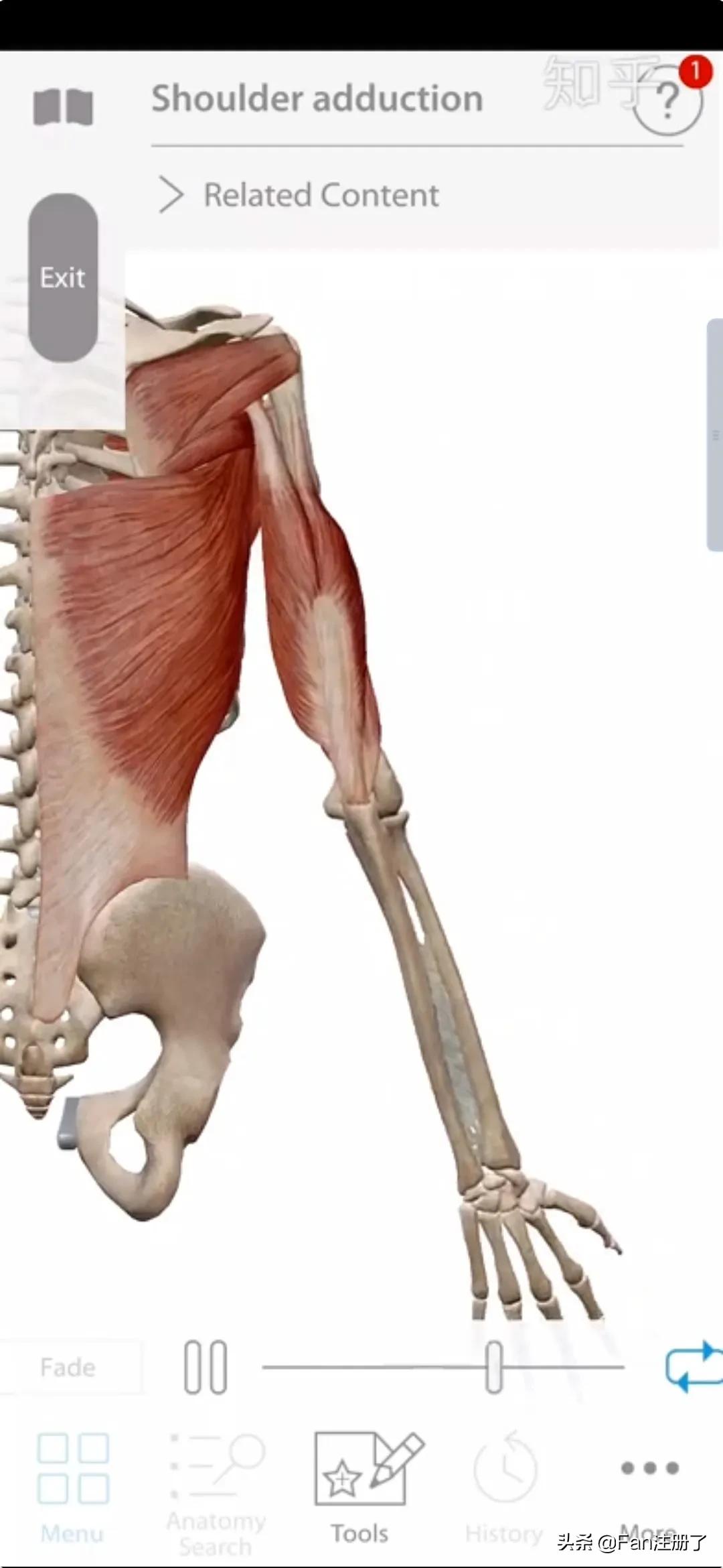 鑲╁嘲涓嬫粦鍥婄値鐥呭洜,鑲╁嘲婊戝泭鐐庝綅缃浘