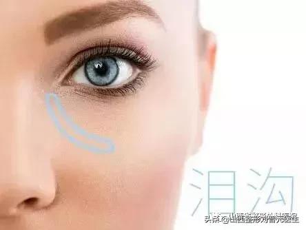 眼袋的*伤杀**力有多大？让小姐姐欲哭无泪