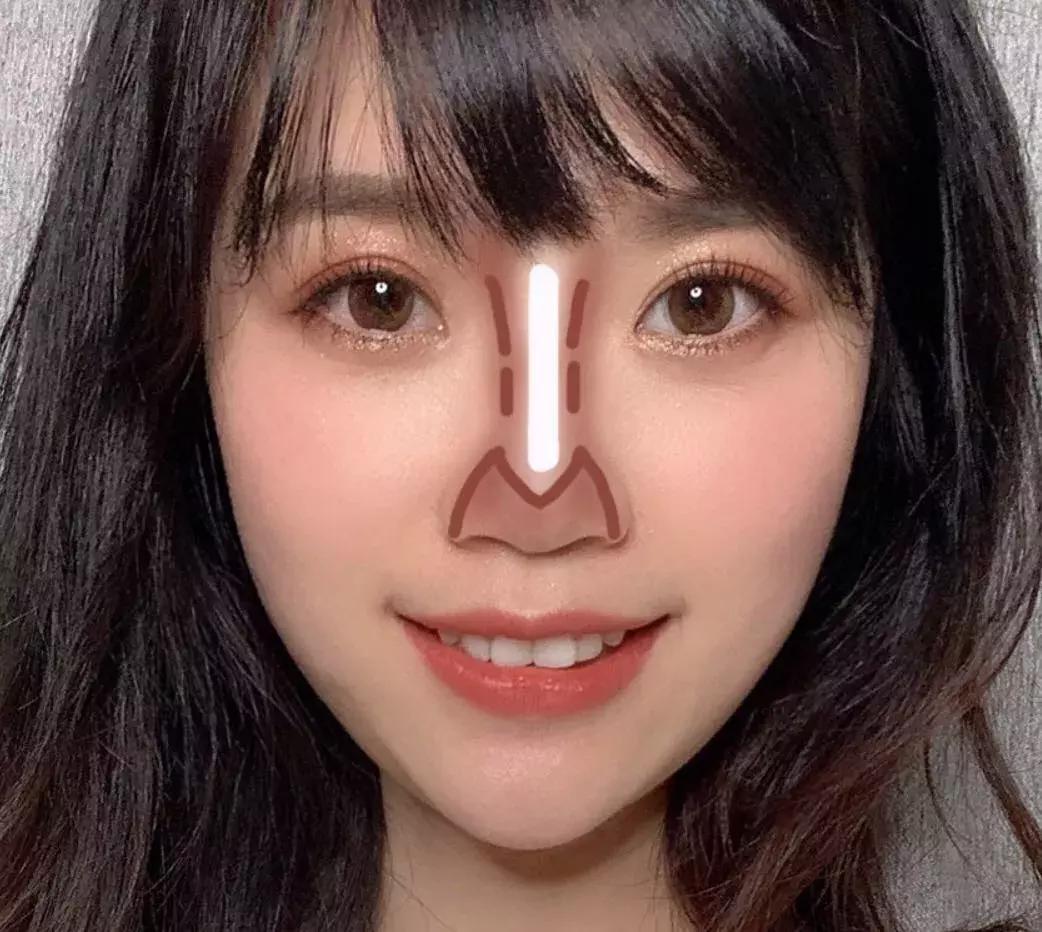 塌鼻子怎么办才显好看,塌鼻子如何让鼻根挺起来