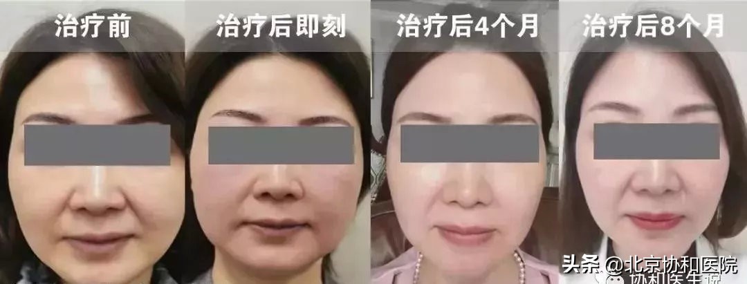 40岁的女人整形手术,40岁女性适合的身体整形医美项目