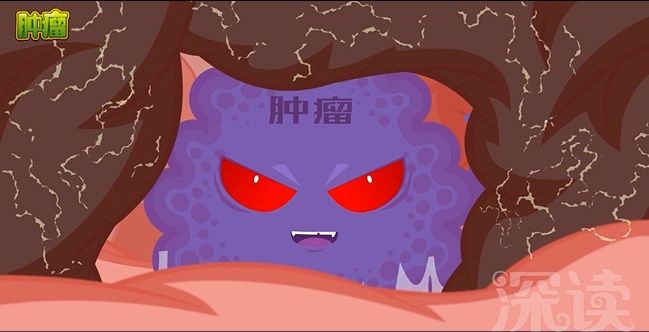 儿童良性癫痫的发病病因,癫痫发病的诱因有哪些