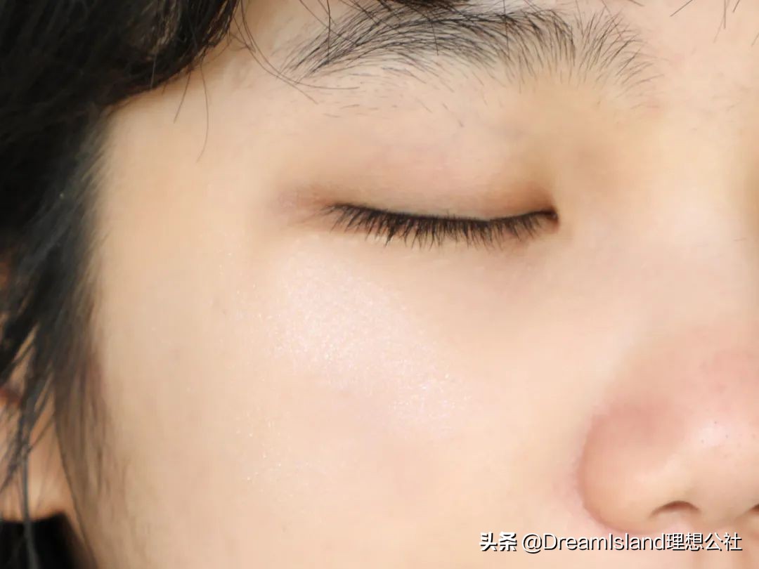 玻尿酸高光排名,打玻尿酸高光推荐