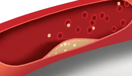 高血压的人吃什么食物降压比较好,高血压90到150要吃哪些食物