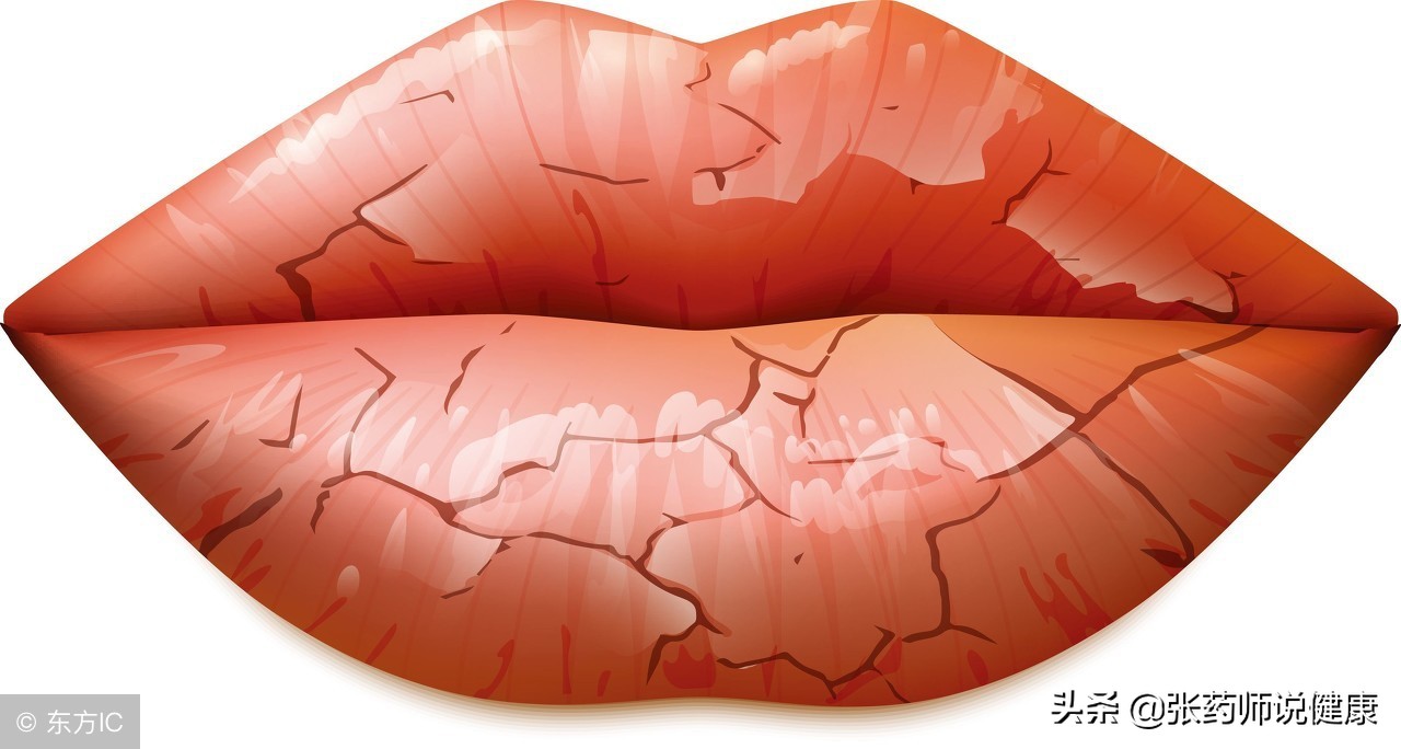 嘴唇发炎怎样治疗,嘴唇发炎怎么改善