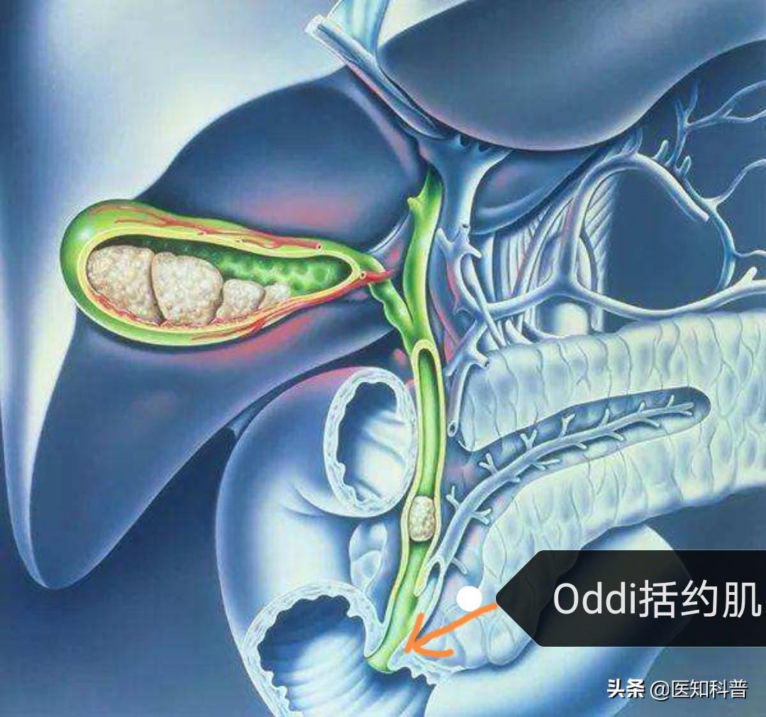 胆囊切除术后大便正常就是上腹胀,老年人胆囊切除手术后腹胀严重