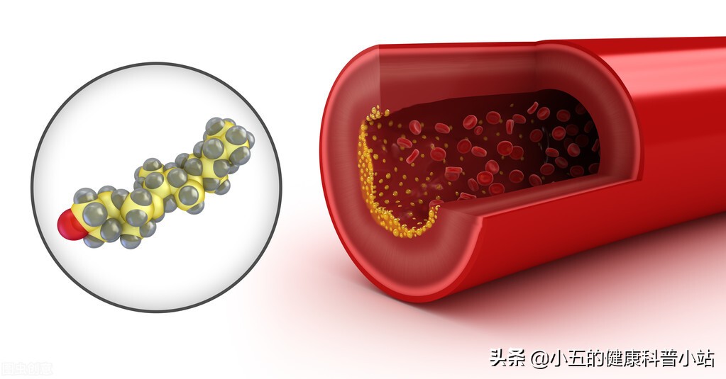 打胰岛素为什么要吃馒头,为什么打胰岛素还需要忌口