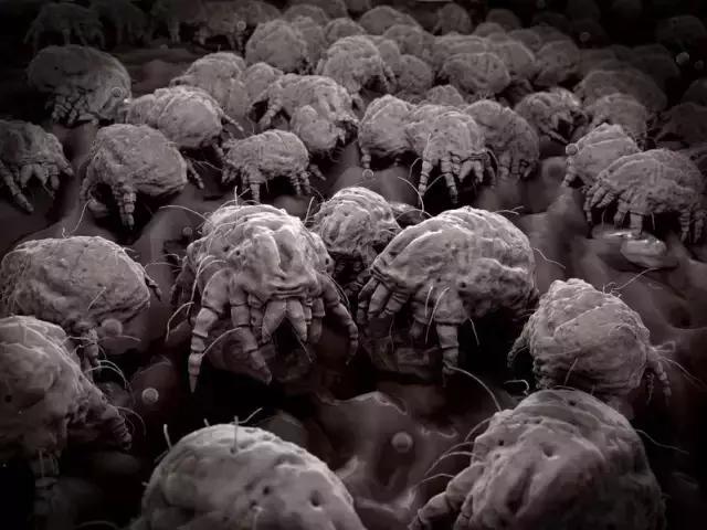 床上有螨虫放什么东西能除螨,床上螨虫和细菌最怕什么