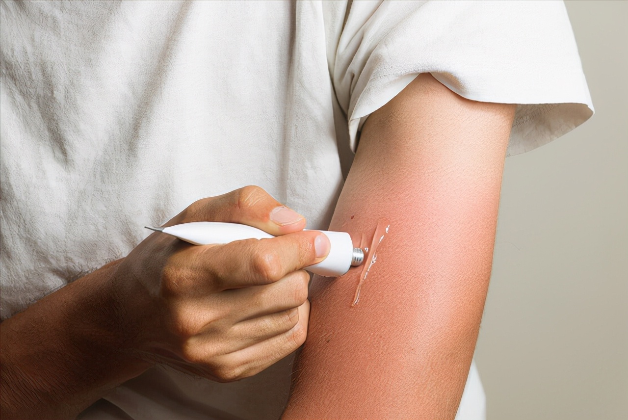 2块钱一支的红霉素软膏3个功效,红霉素软膏几块的和几十的区别