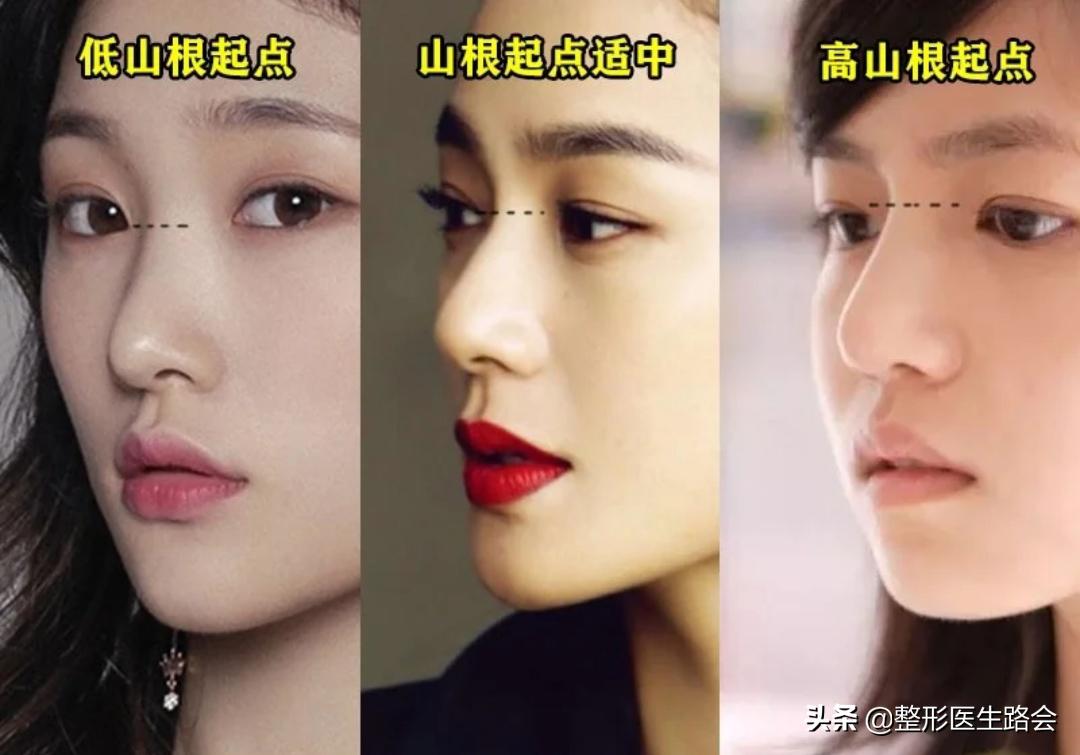 直鼻、直鼻微翘、翘鼻、微驼峰，好看的鼻子怎么选？