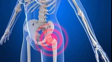 胯骨疼站立时间长了麻,胯骨痛走路都疼怎么回事