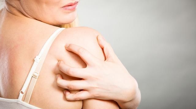 慢性顽固性皮肤湿疹荨麻疹治疗,湿疹荨麻疹神经性皮炎能根治吗