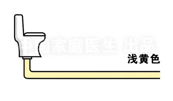 上厕所有四个症状说明肝有问题,上厕所时肾有刺痛是怎么回事