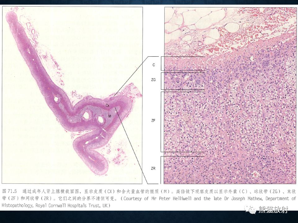 纵隔和肾上腺恶性肿瘤,纵隔性肿瘤位置图