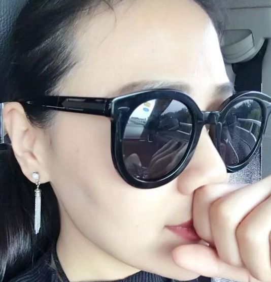 额头扁平怎么填充自然好看,额头颞部怎么填充好看