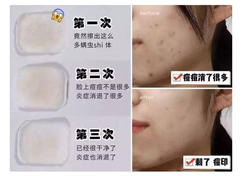 ​建议皮肤“坑洼”的女生，多在这件事花功夫，脸上净爽还更嫩了