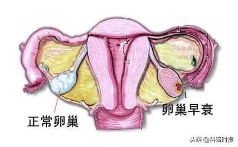 专家介绍卵巢衰老,科普时报电子版2021