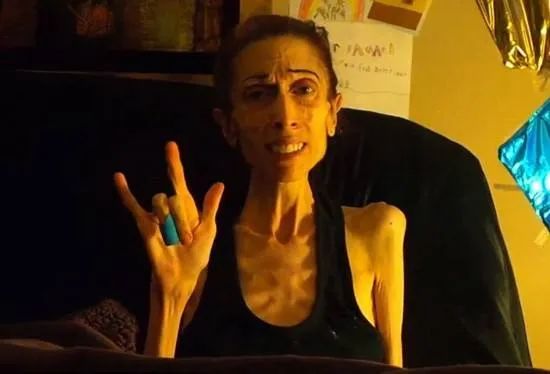 维秘超模七年不来月经！她们的“健康美”让无数效仿者身体垮掉