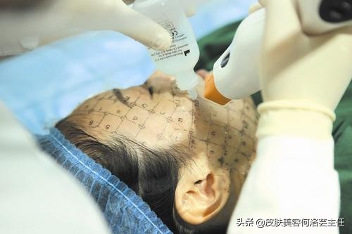 热玛吉操作时正确的手法,热玛吉医生操作时有技巧吗