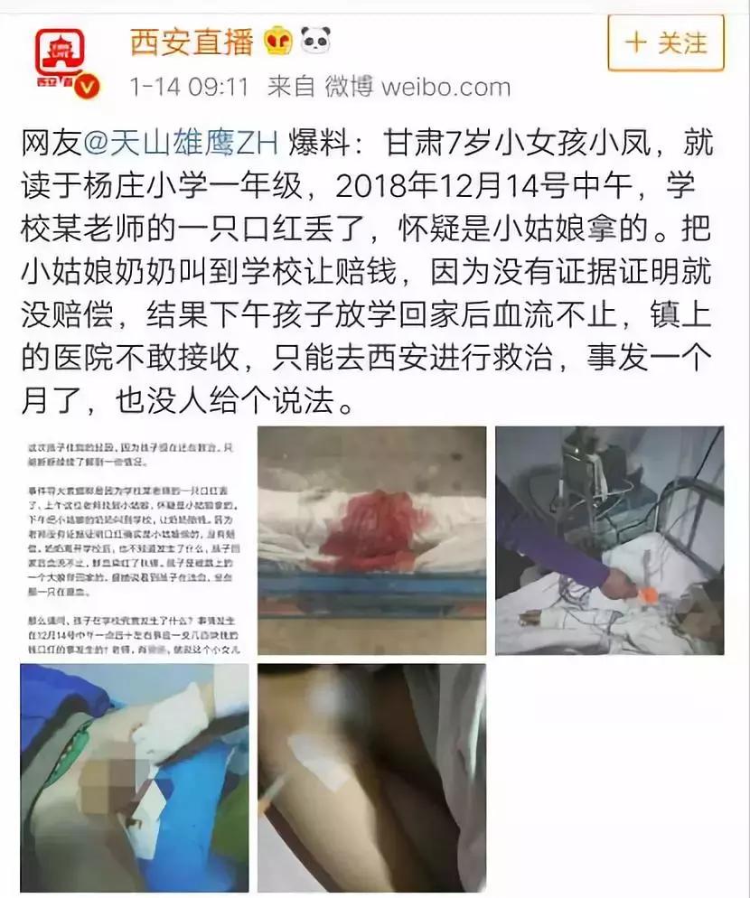 8岁女童被残忍打伤*体下**，还有疑问仍需解答