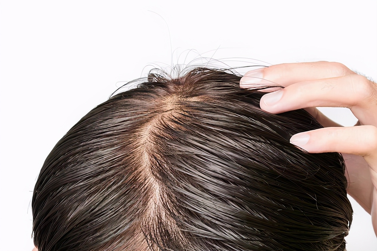 下雨天头发炸毛怎么护理,如何拯救头发干燥