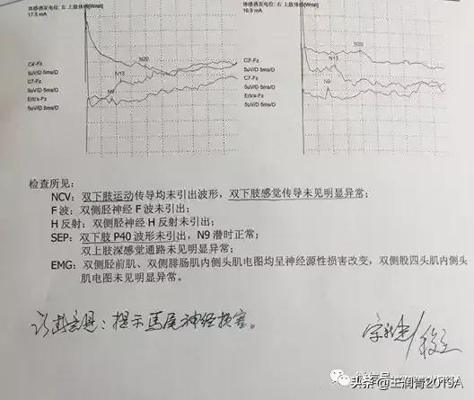 弯腰捡东西，腰痛腿麻大小便*禁失**，竞是腰椎间盘髓核脱出惹的祸