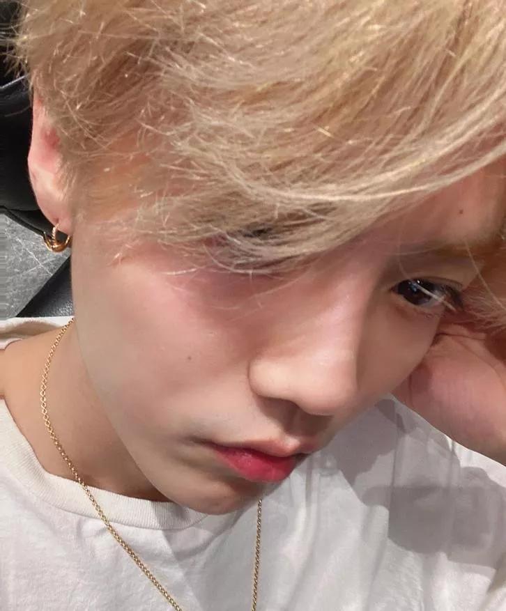 毛孔粗大如何改善治愈系,解决毛孔粗大最有效医美的方法