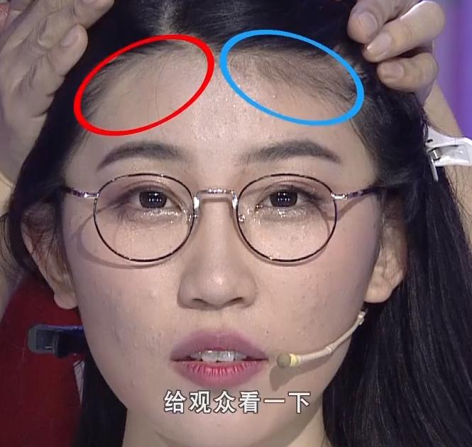 额头太窄适合的发型,额头窄不要刘海怎么扎