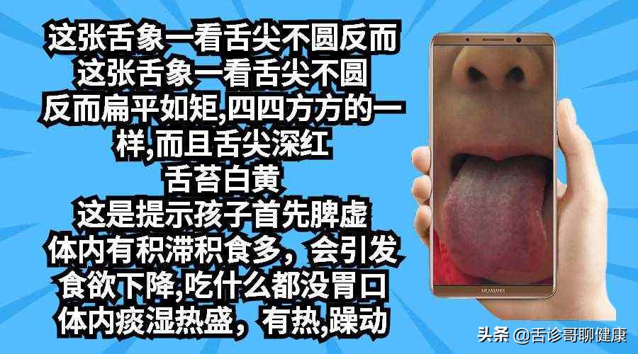 舌诊歌舌象分析与感悟,舌诊哥聊健康痰湿