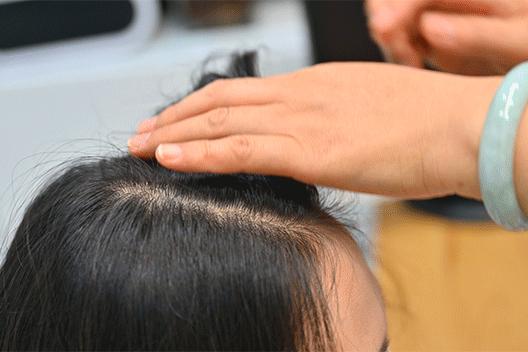 叹头部SPA！拒做人间“油”物，解锁防秃养发小妙招