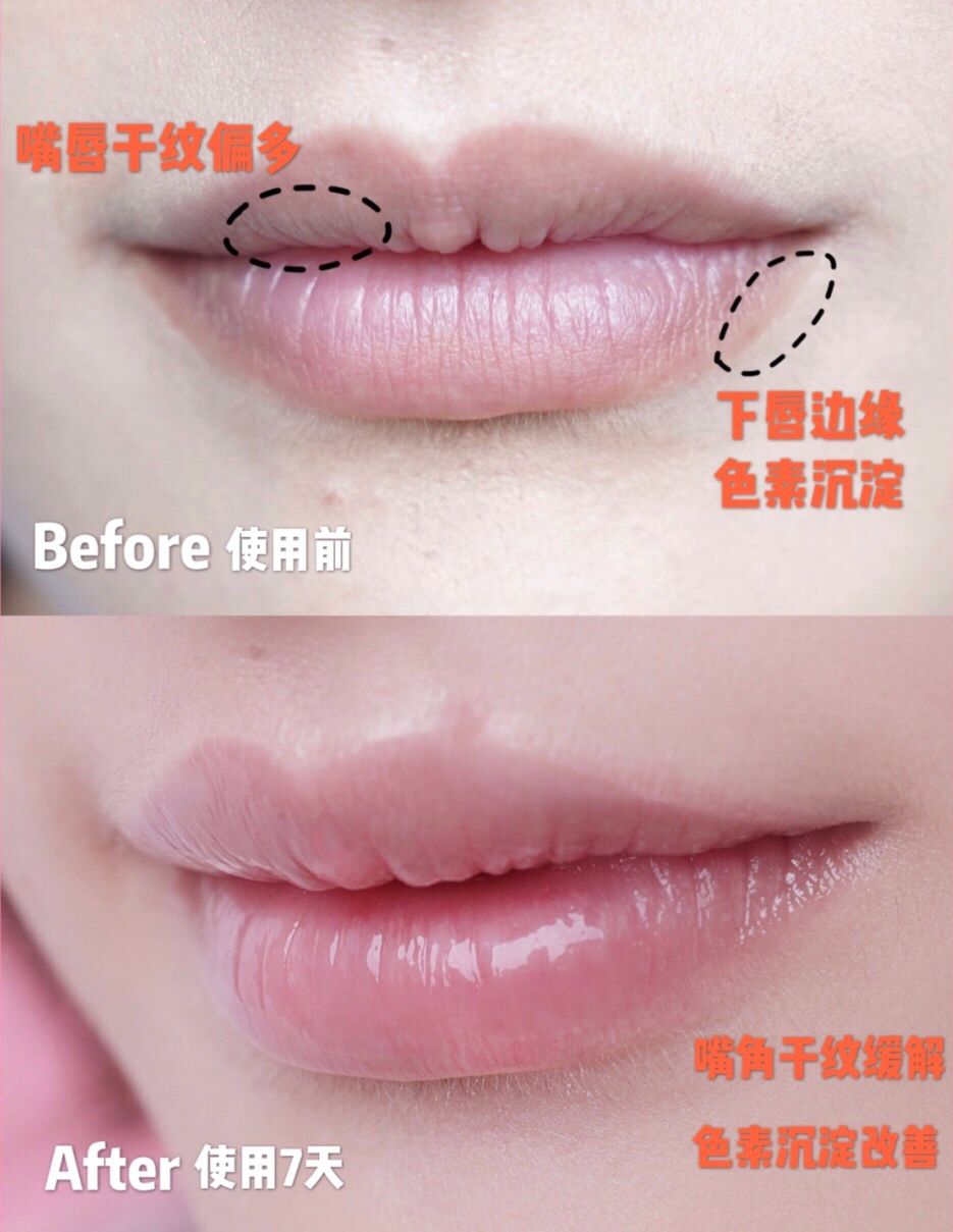 周冬雨唇形,周冬雨的脸高级吗