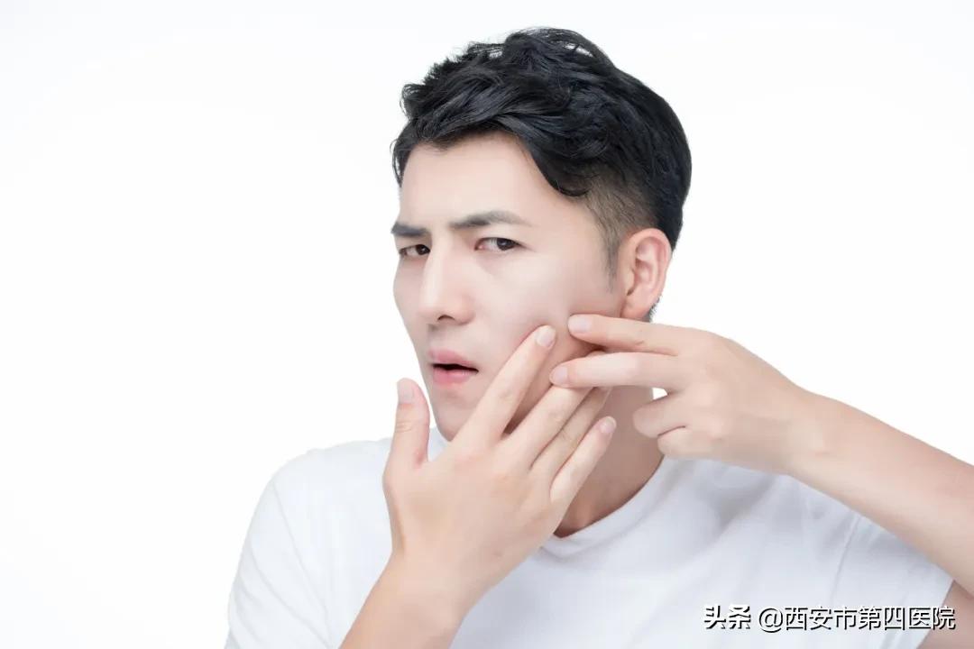 点阵激光能不能改善肤色,做完点阵激光后如何美白