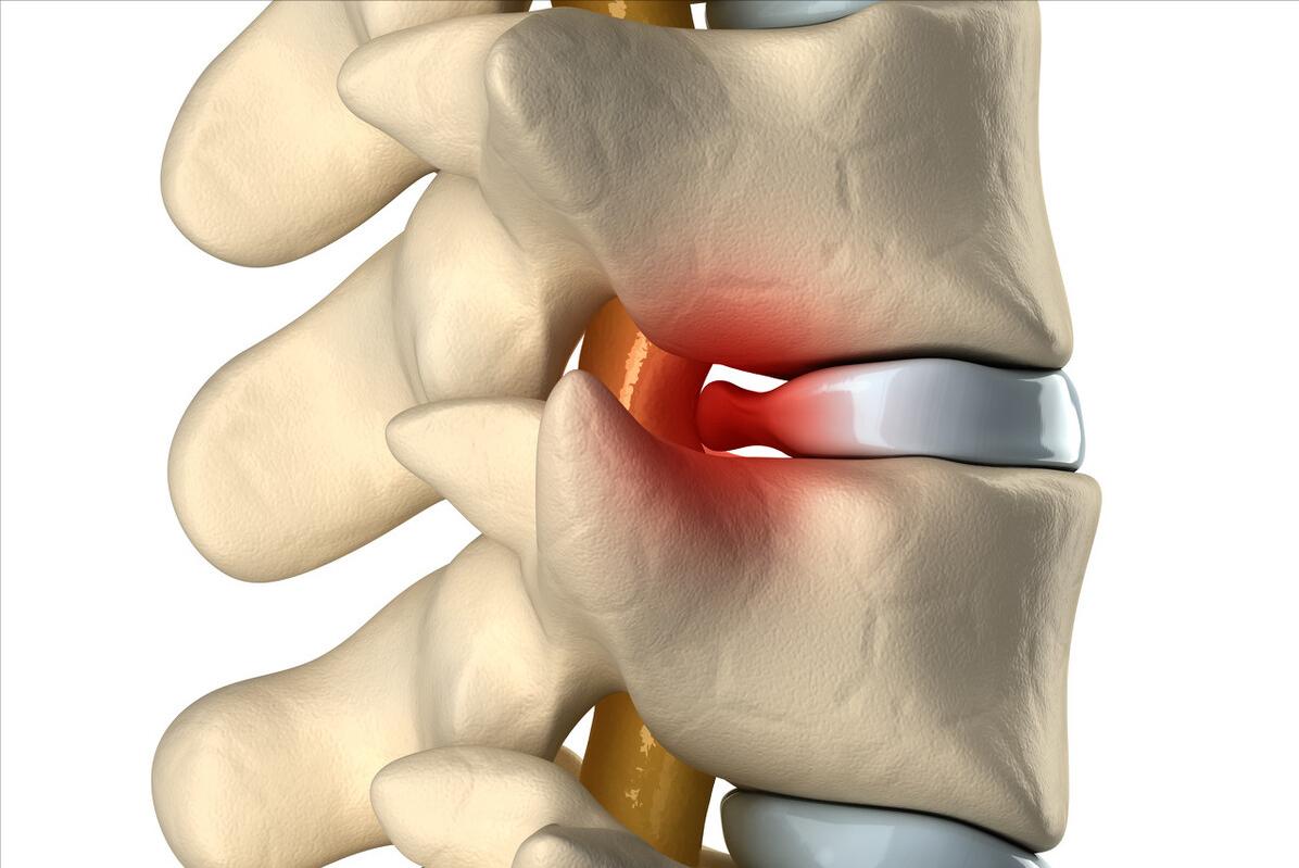 调整坐的姿势改善驼背,调整坐姿走姿让腿越来越直