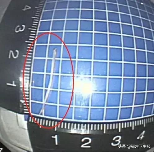 福州市一医院发生医疗事故,事发福州1人身亡1人尚在icu
