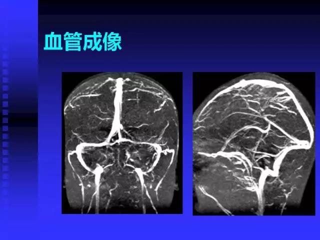 头颅mri读片视频教程,颅脑mri读片入门教程视频讲解全集