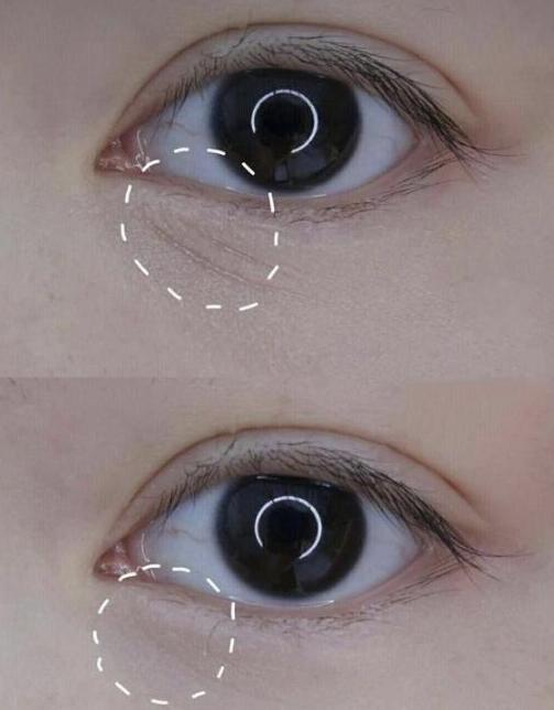 戚薇力荐的眼霜，用后黑眼圈细纹都没了，李佳琦：确实不错