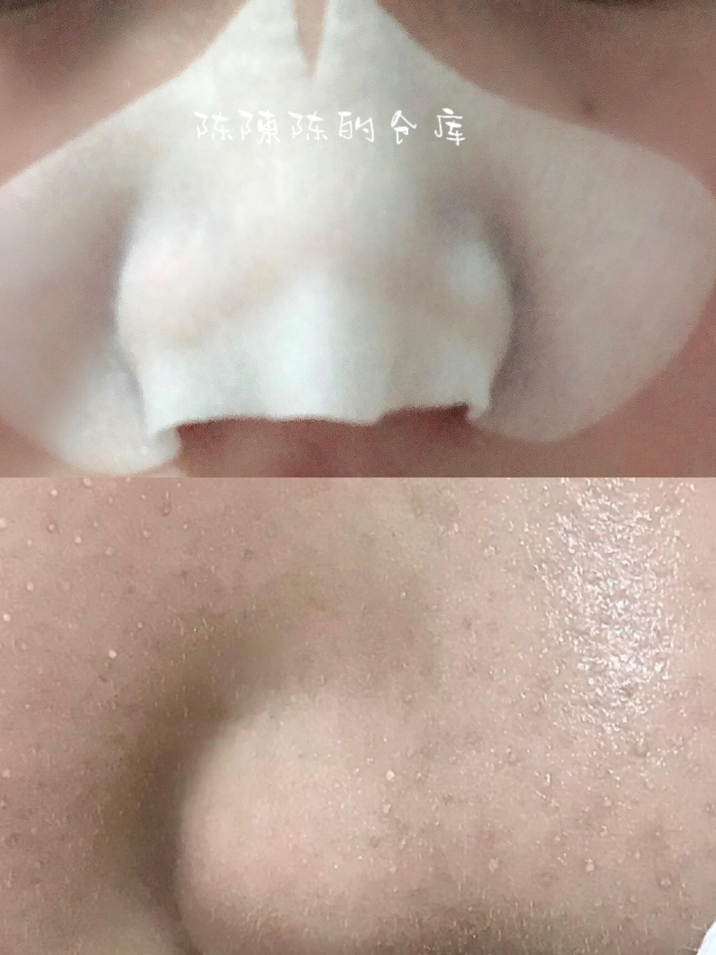 李佳琦推荐去黑头产品真的好用吗,吸黑头神器李佳琦推荐