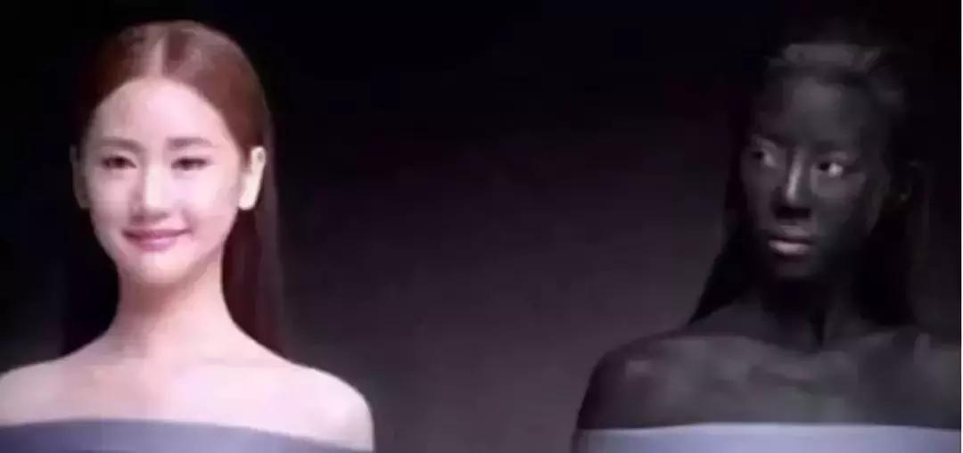 毛孔大怎么改善真的可以收缩毛孔,毛孔粗大怎么办怎么有效收缩毛孔