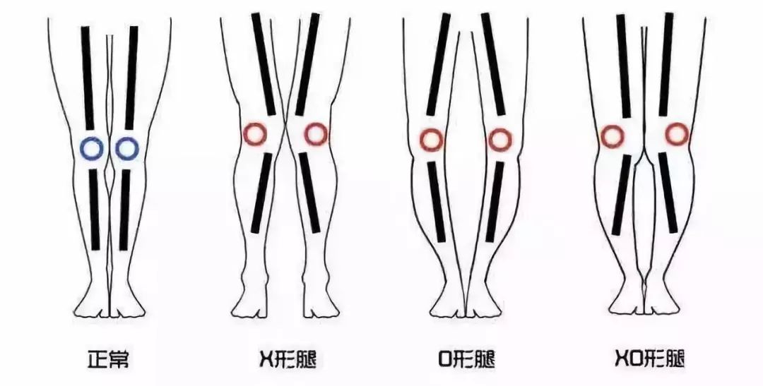 上身很瘦但是腿特别粗,假胯宽的原因和调整