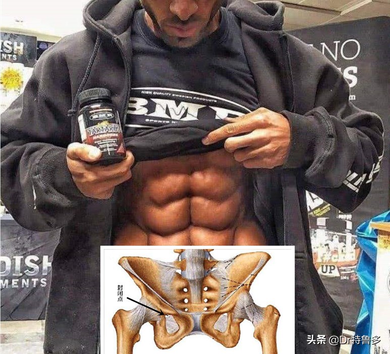 大腿内侧疼是压迫哪根神经引起的,大腿内侧神经疼要警惕