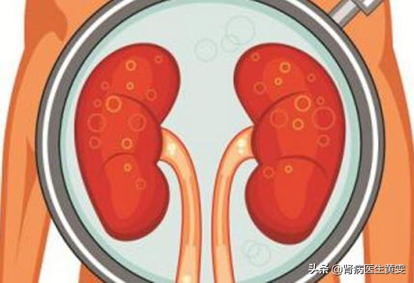 女性口干眼干是什么原因,女性眼干口干舌燥是肝病吗